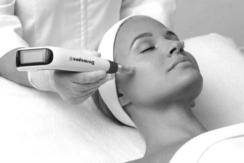 skin-needling-dermapen skin-needling-dermapen
